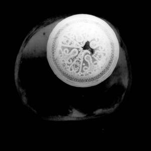 Røntgenbillede af cirkulær fibula fra Østermarie Kirke